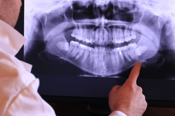 Best Emergency Dentist for Lost Fillings or Crowns in Keene, TX