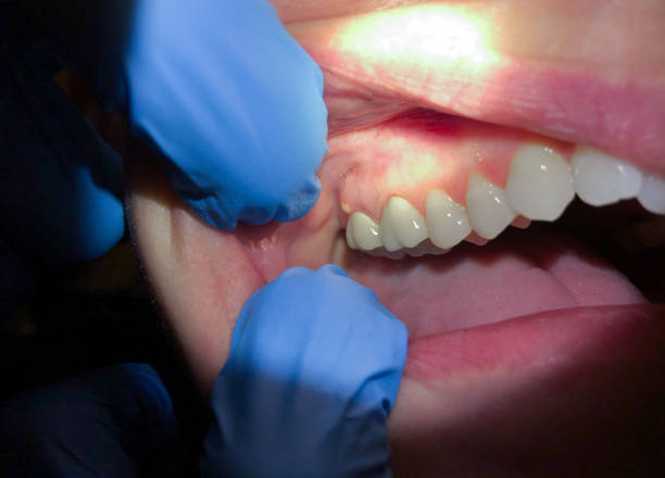 Best Holiday Emergency Dentist in Keene, TX