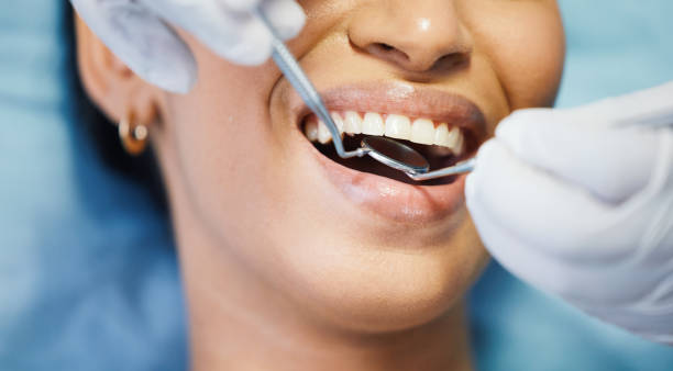Best Emergency Dentist for Special Needs Patients in Keene, TX
