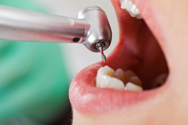 Best 24-Hour Emergency Dentist in Keene, TX